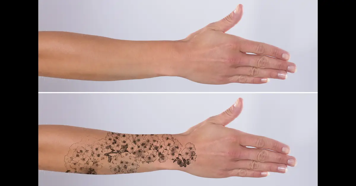 How To Remove Tattoos At Home For Free